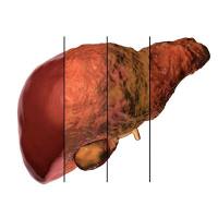 药物肝脏毒性评价