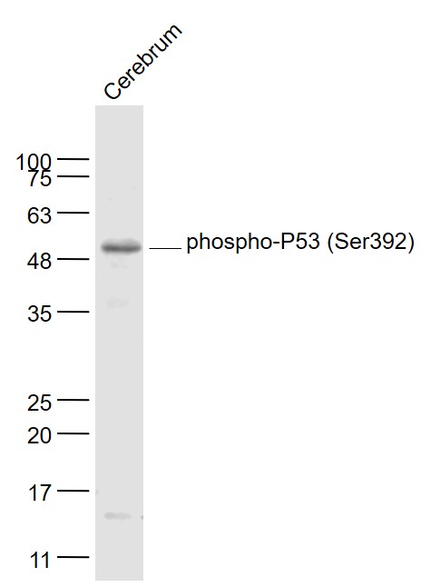 phospho-P53 (Ser392) Rabbit pA