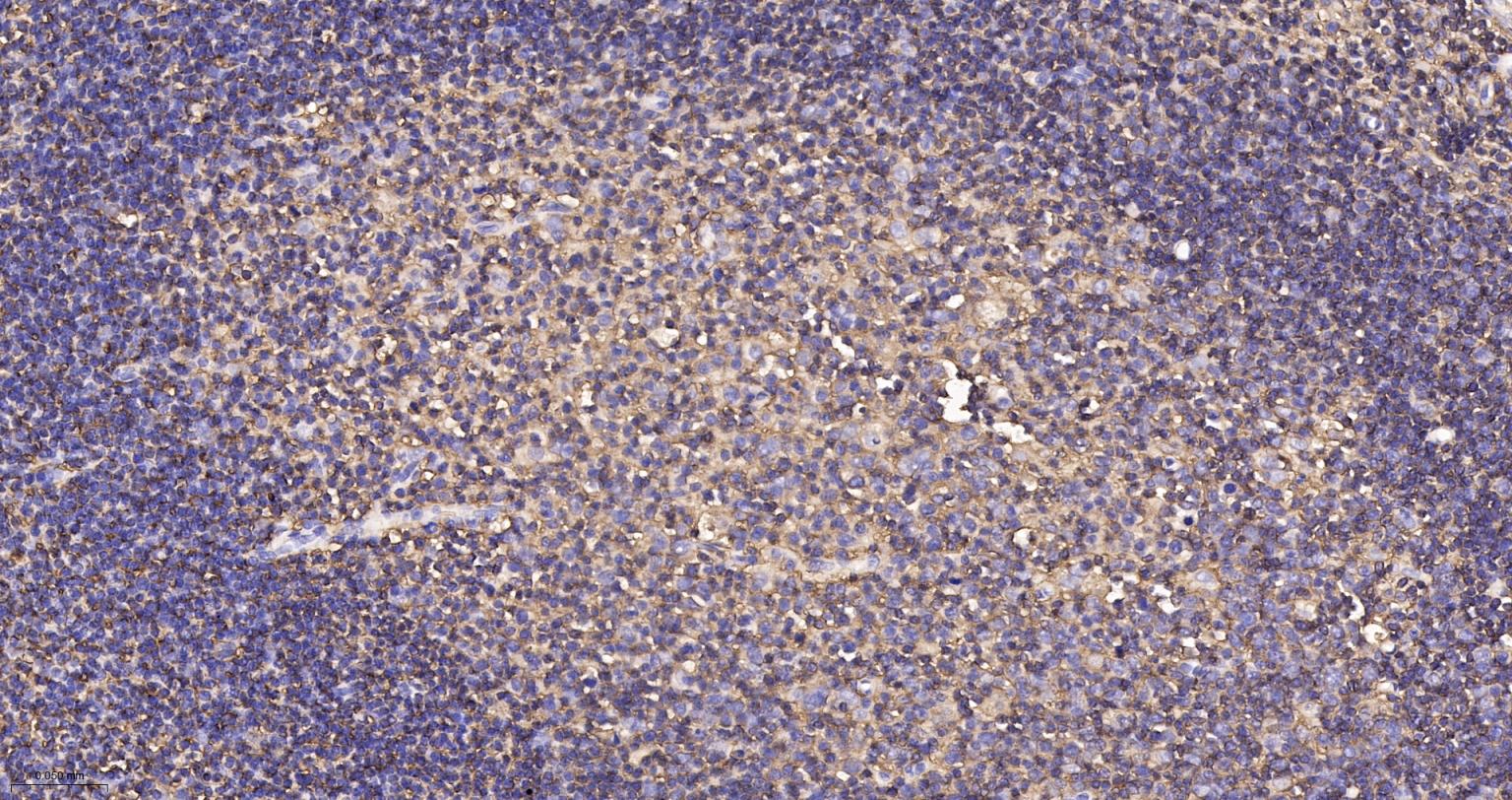 CD44 Recombinant Rabbit mAb(bs