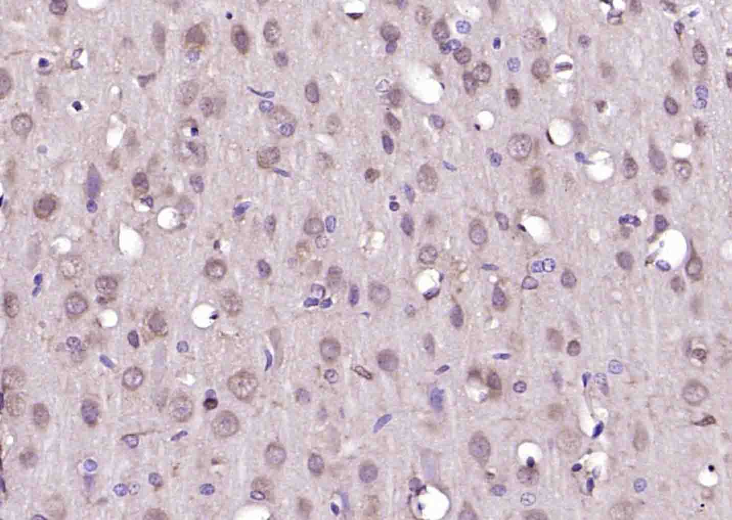 LKB1 Rabbit pAb(bs-3948R)-50ul