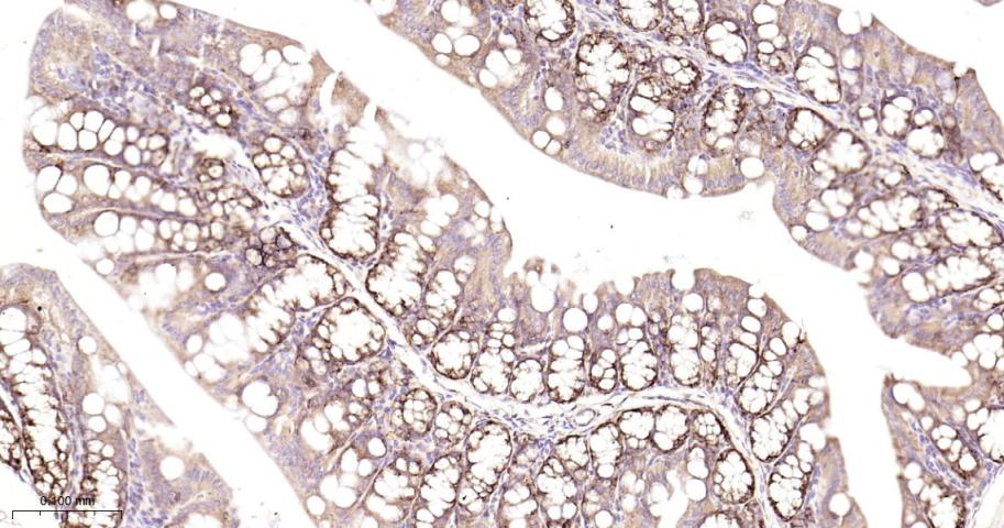 AGR2 Recombinant Rabbit mAb(bs