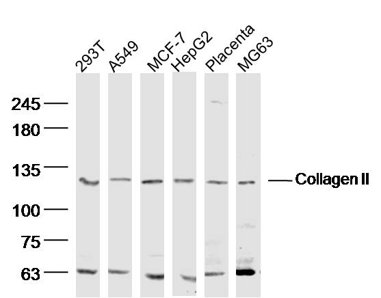 Collagen  II Rabbit pAb(bs-070