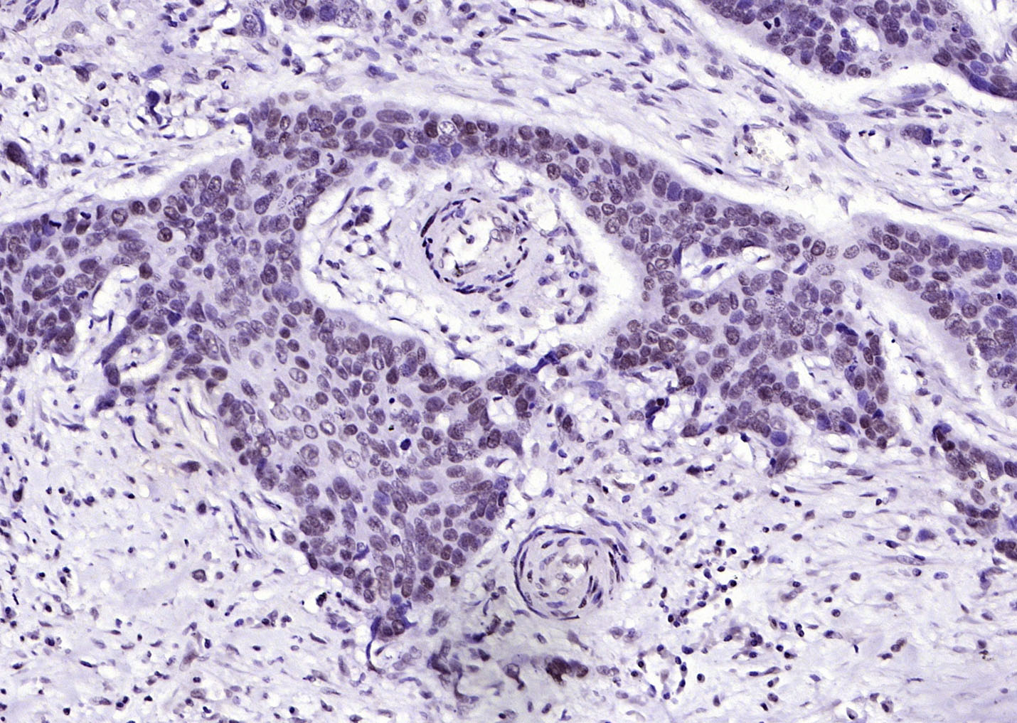 phospho-FGFR1 (Tyr307) Rabbit 