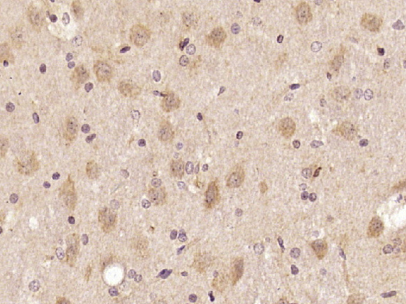 SIPA1L2 Rabbit pAb(bs-7927R)-5