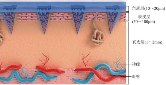 魅罗科技（MeloPEG）提供包衣微针（涂层微针/表面载药微针）定制服务，让药物递送更精准、更高效