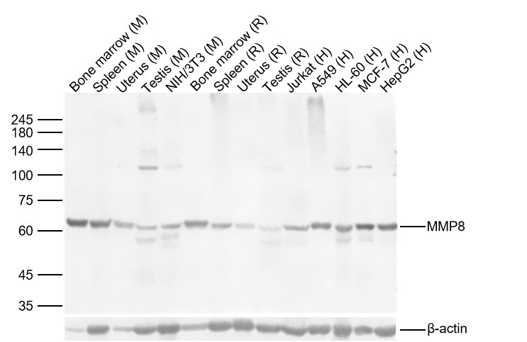 MMP8 Rabbit pAb(bs-1913R)-50ul
