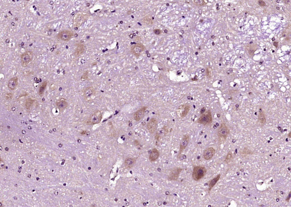 SEMA6D Rabbit pAb(bs-2943R)-50