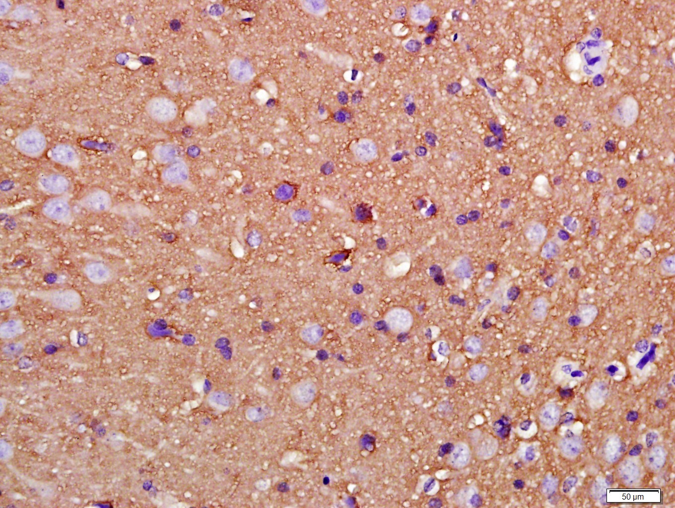 GPM6A Rabbit pAb(bs-10757R)-50