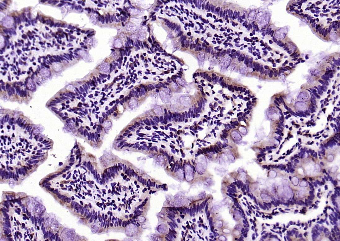 PEPT1 Rabbit pAb(bs-0689R)-50u