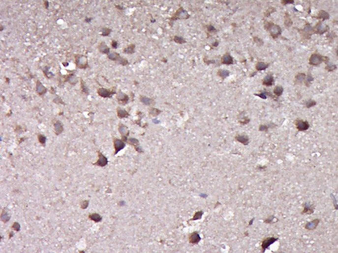 KIAA0859 Rabbit pAb(bs-16984R)