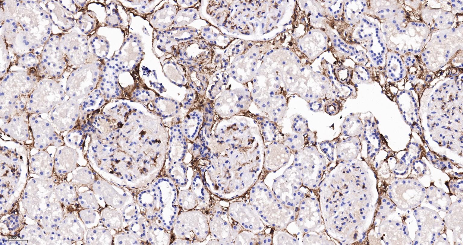CD44 Recombinant Rabbit mAb(bs