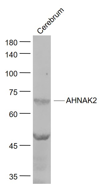 AHNAK2 Rabbit pAb(bs-9094R)-50