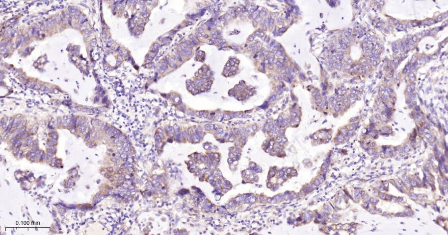 EIF2S1 Recombinant Rabbit mAb(