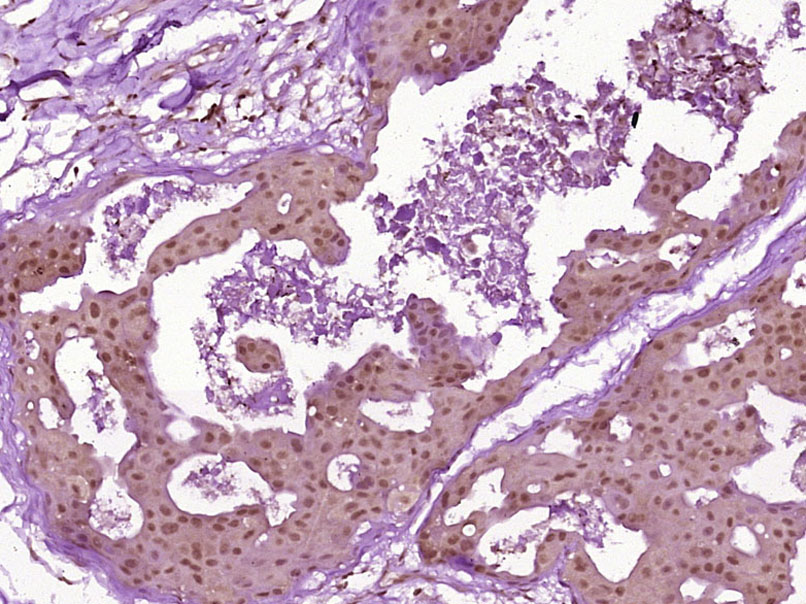 CHEK2 Rabbit pAb(bs-1391R)-50u