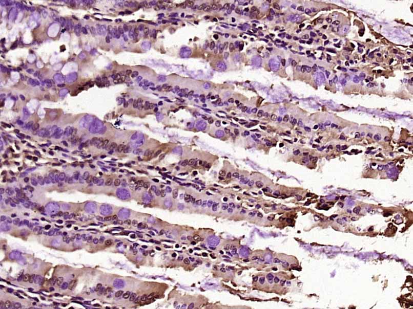 CCDC160 Rabbit pAb(bs-8123R)-5