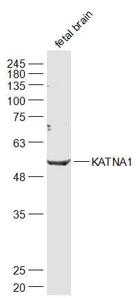 KATNA1 Rabbit pAb(bs-9308R)-50
