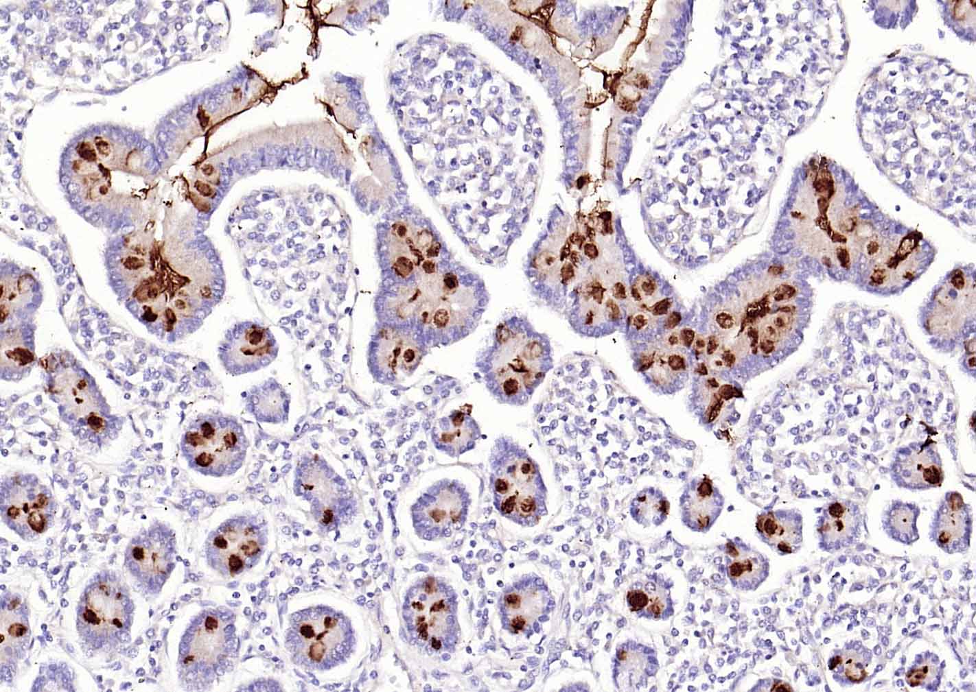 MUC2 Rabbit pAb(bs-60331R)-50u