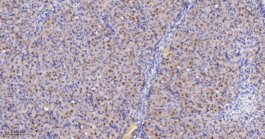 KDM4B Recombinant Rabbit mAb(b