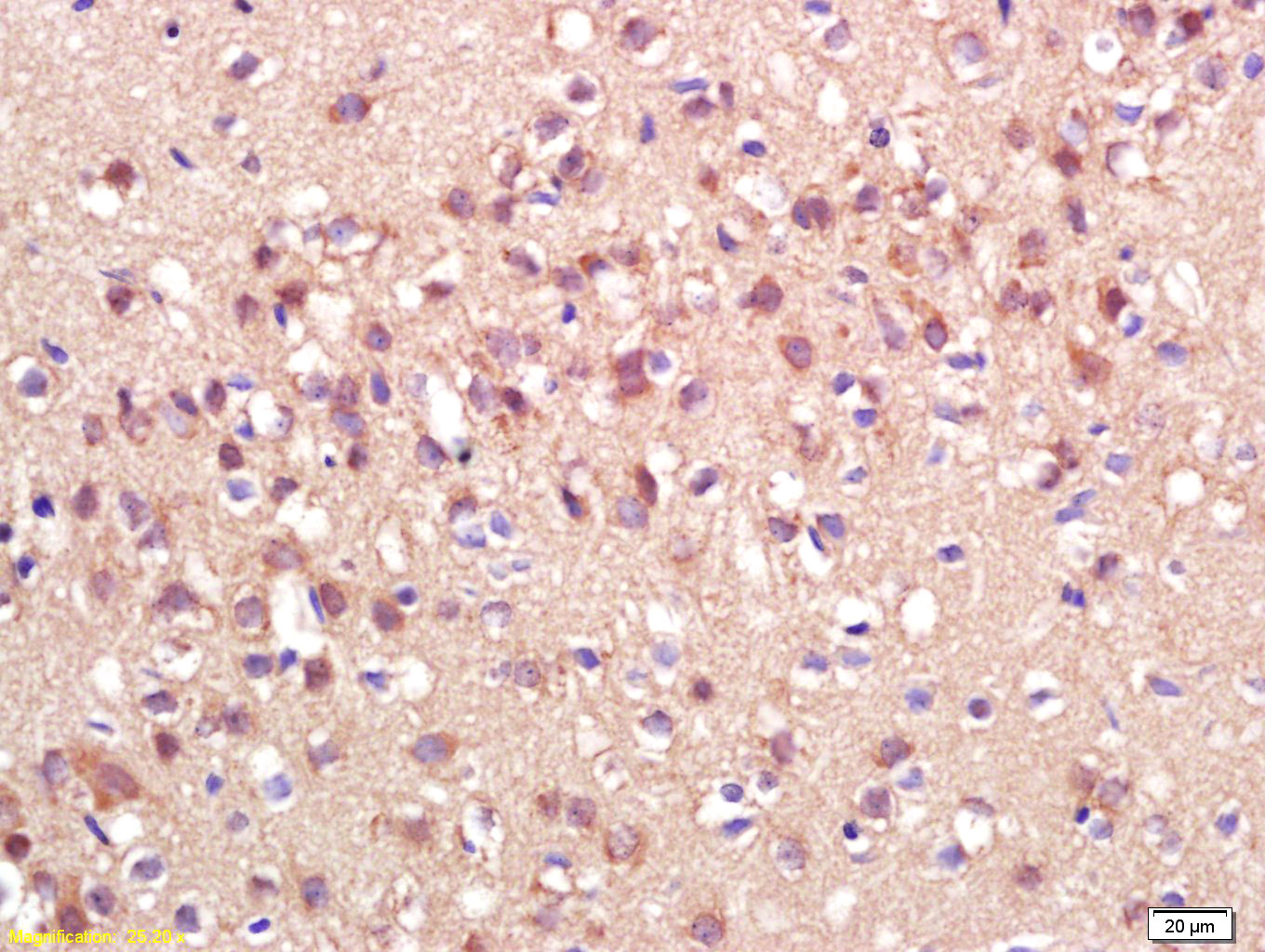 ADAMTS7 Rabbit pAb(bs-0433R)-5