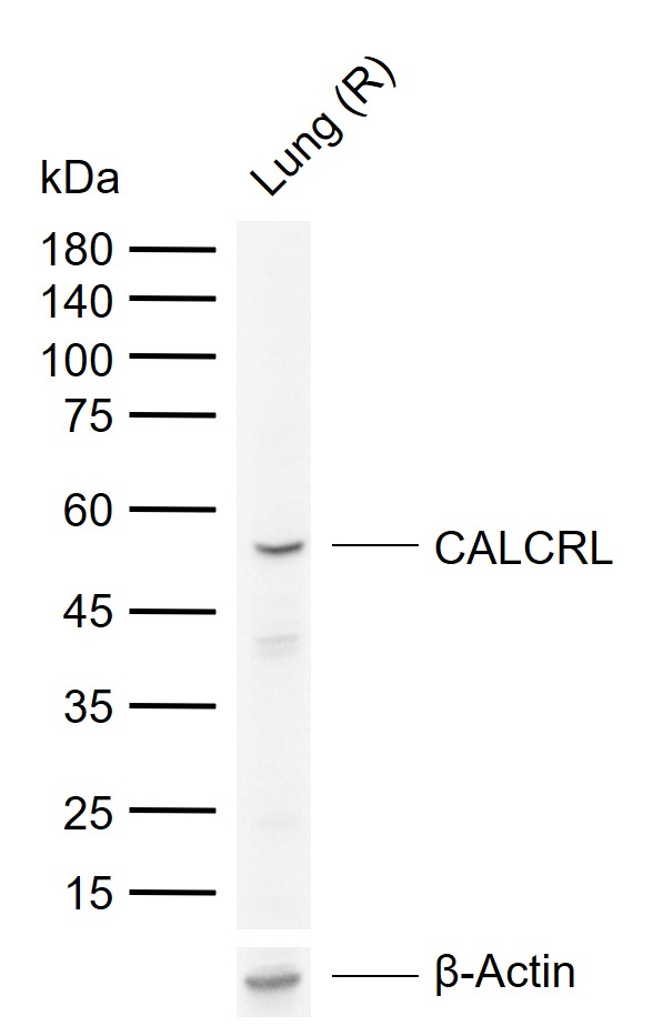 CALCRL Rabbit pAb(bs-1860R)-50