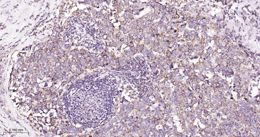 SDHB Recombinant Rabbit mAb(bs