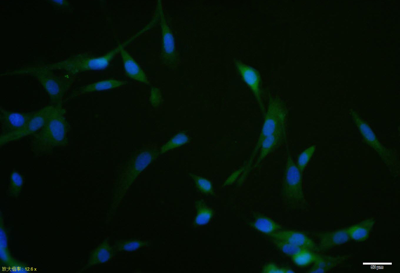 RARB Rabbit pAb(bs-0516R)-50ul