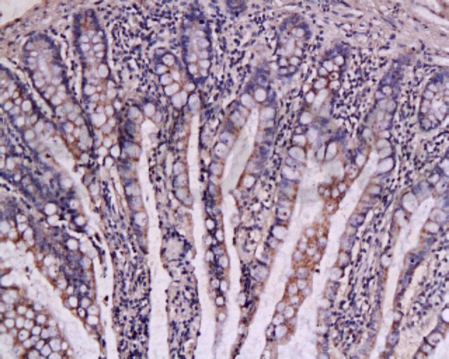 TFPI-2 Rabbit pAb(bs-1144R)-50