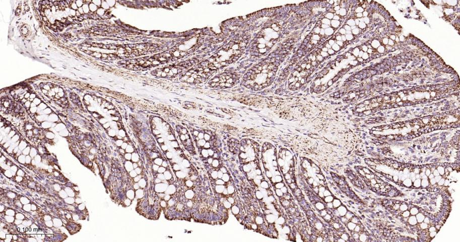SDHB Recombinant Rabbit mAb(bs