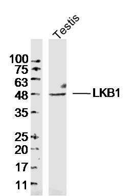 LKB1 Rabbit pAb(bs-3948R)-50ul