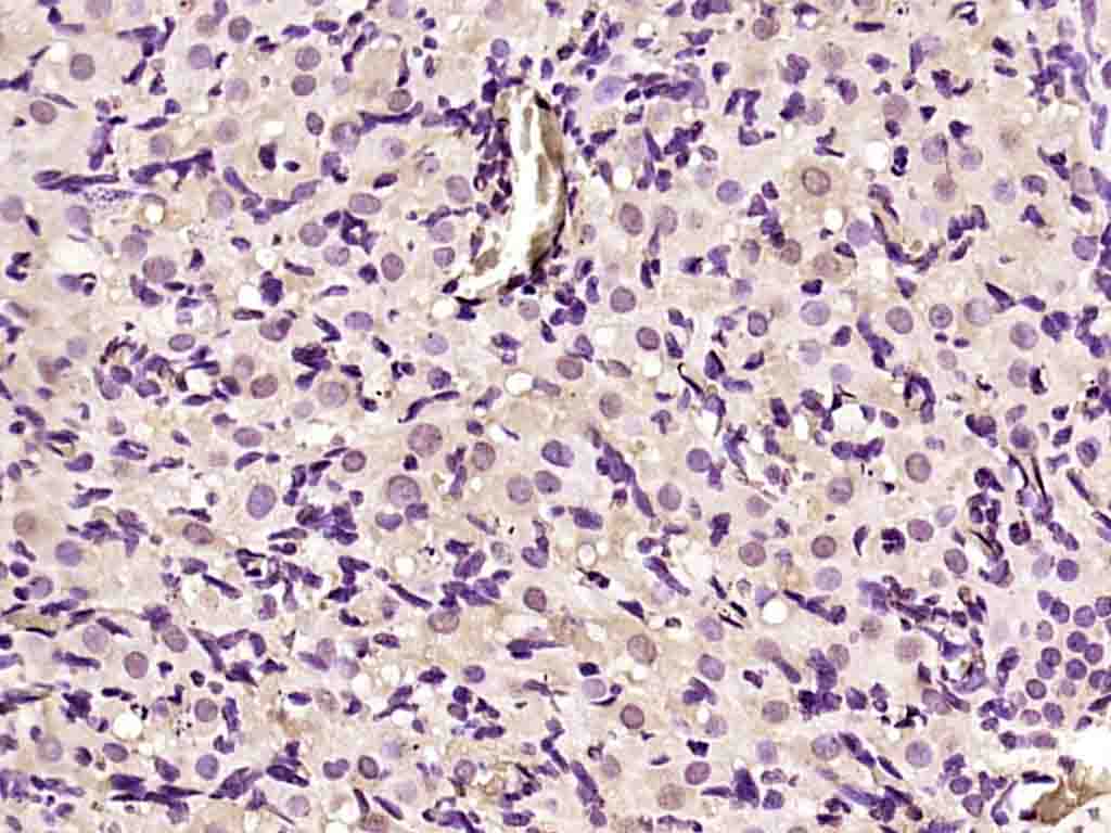 phospho-APC1 (Ser355) Rabbit p