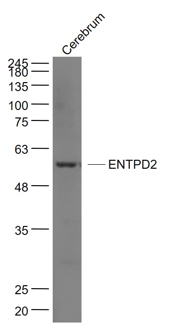 ENTPD2 Rabbit pAb(bs-11515R)-5