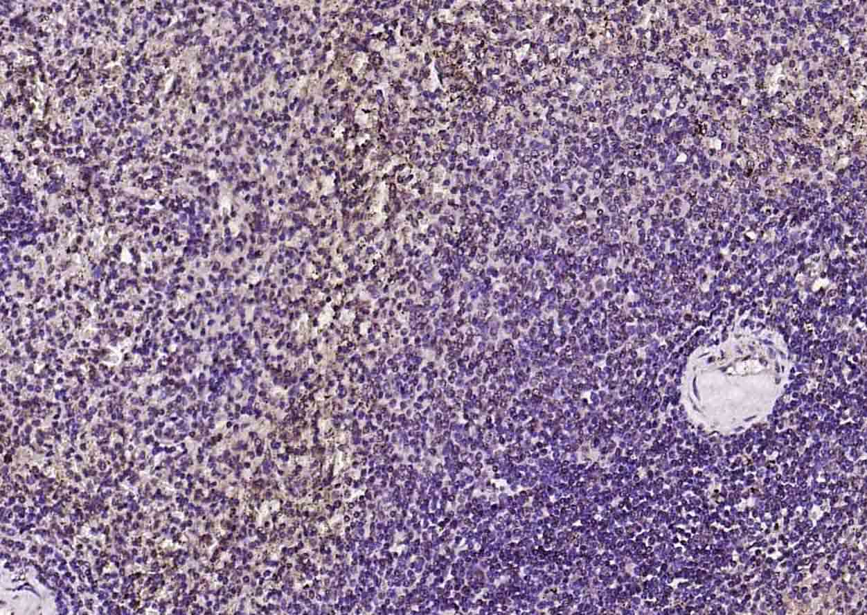 AMPK beta 1/PRKAB1 Rabbit pAb(