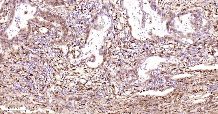Hsp27 Recombinant Rabbit mAb(b