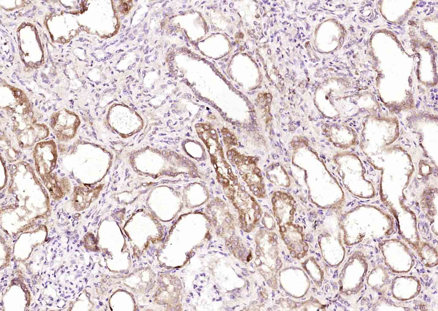 phospho-DDX58 (Thr170) Rabbit 