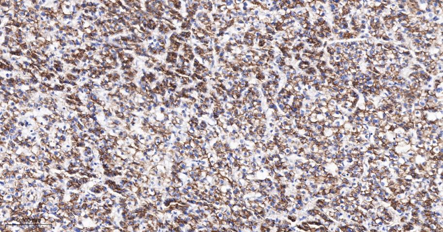 N-cadherin Mouse mAb(bsm-34125