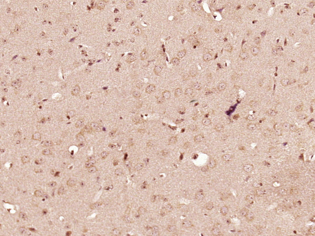 PDGFBB Rabbit pAb(bs-1316R)-50