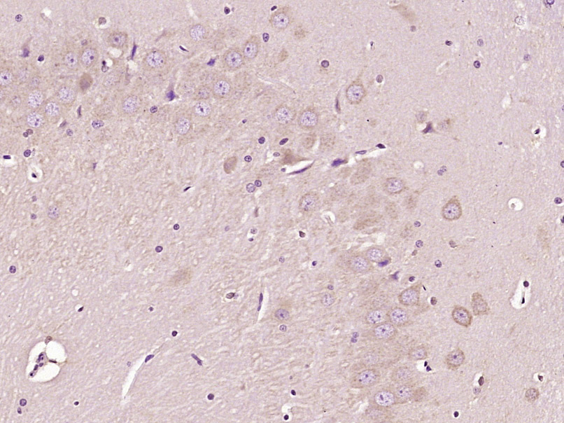 HECT E3 ubiquitin ligase Rabbi