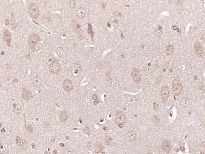 Gamma Synuclein Rabbit pAb(bs-