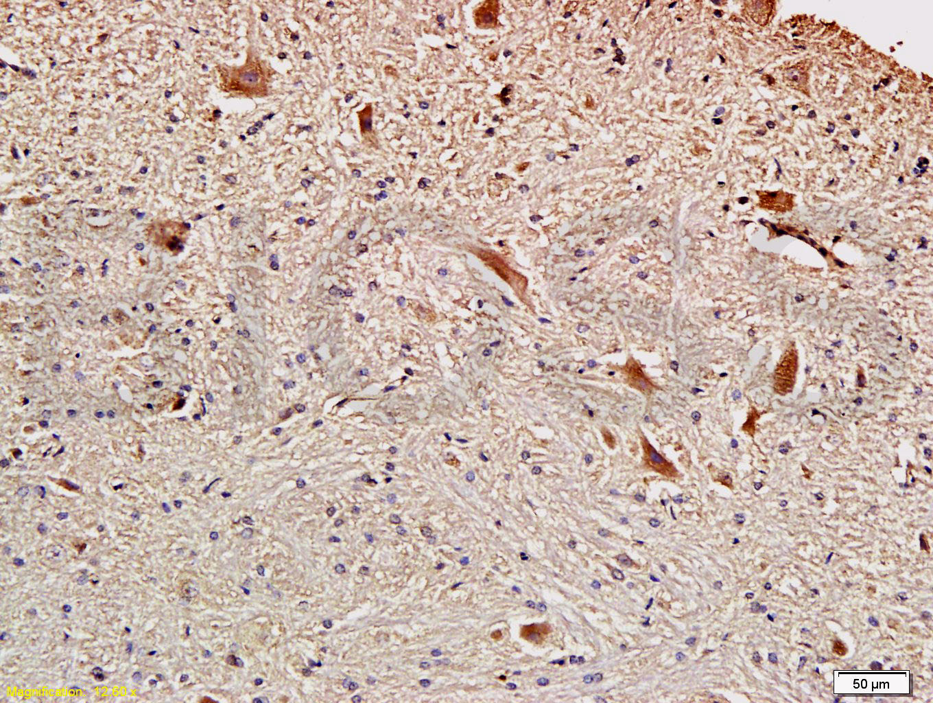 FSCN1 Rabbit pAb(bs-0796R)-50u