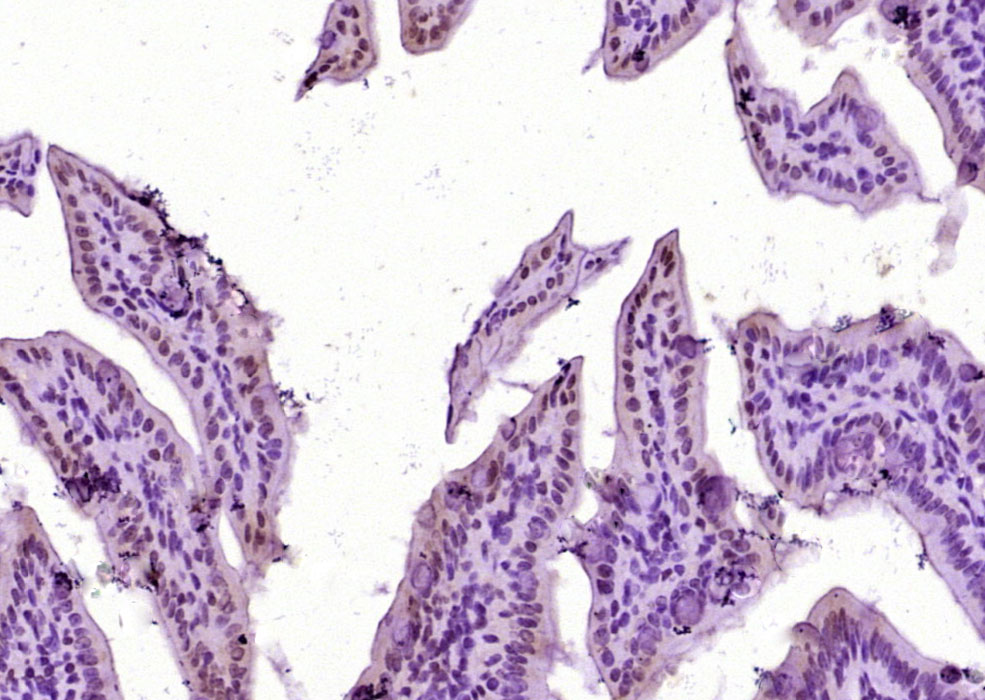 LPP Rabbit pAb(bs-3861R)-50ul/