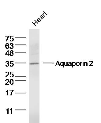 AQP2 Rabbit pAb(bs-0261R)-50ul