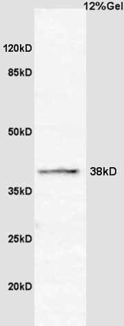 CCNG2 Rabbit pAb(bs-3822R)-50u