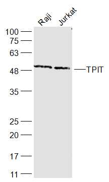 TPIT Rabbit pAb(bs-17167R)-50u