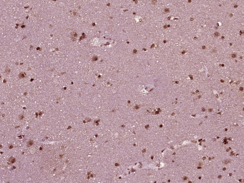 phospho-MEK1 + MEK2 (Ser222) R