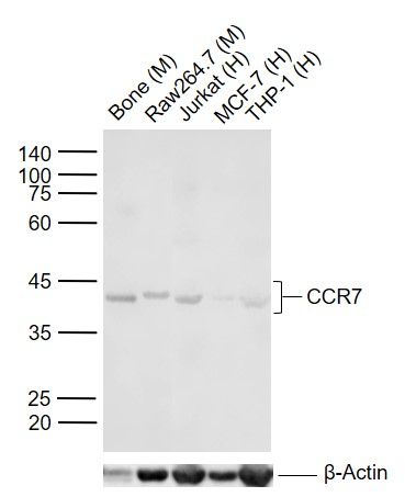 CCR7 Rabbit pAb(bs-1305R)-50ul