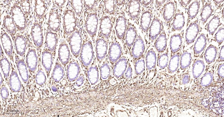 Hsp27 Recombinant Rabbit mAb(b