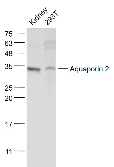 AQP2 Rabbit pAb(bs-0261R)-50ul