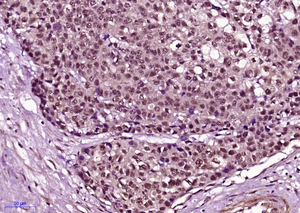 phospho-Cyclin B1 (Ser126) Rab