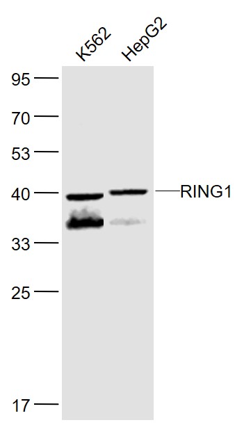 RING1 Rabbit pAb(bs-6142R)-50u