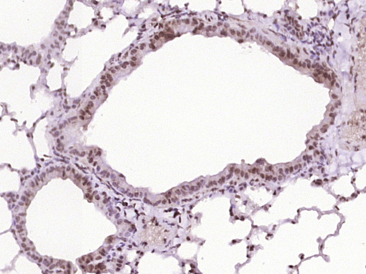 phospho-BTK (Tyr223) Rabbit pA